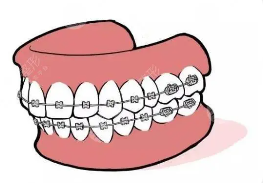 Can adults straighten their teeth?