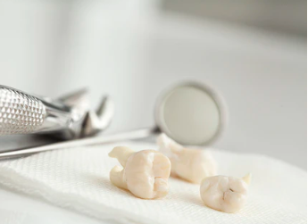 Wisdom Teeth Torment a British Man for Months, Causing Him to Commit Suicide due to Unbearable Pain