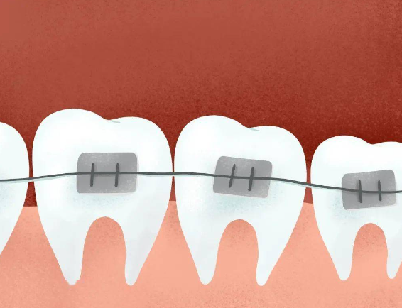Can adults have orthodontics?