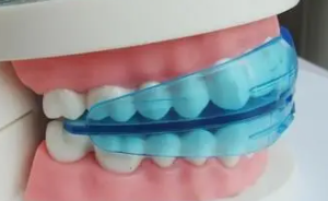 Here are a few things you need to know before adult orthodontics!