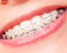 Two Notes on Orthodontics for Adults