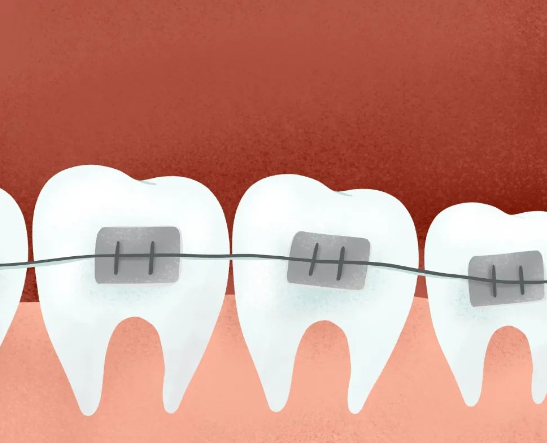 Can a 34-year-old tooth with towers be corrected?