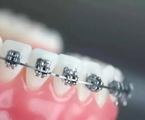 What are the sequelae and hazards of adult orthodontics? 