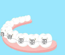 Orthodontic Methods for Adults