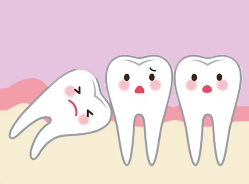 What are the four types of people who can not have dentures?