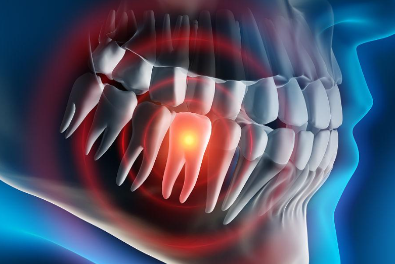 What are the causes of toothache in children?