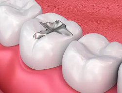 What to do if there is a big hole in the middle of the tooth?