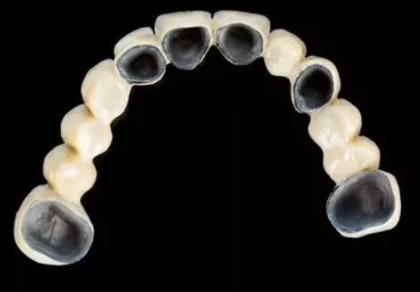 The main part of porcelain teeth chipping
