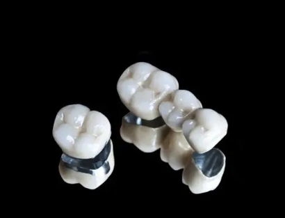 What are the advantages of porcelain teeth?