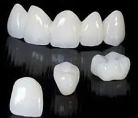 What are the advantages of all-ceramic teeth?