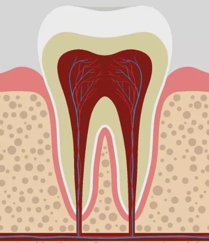 How long does it take for facial swelling to go away due to pulpitis?