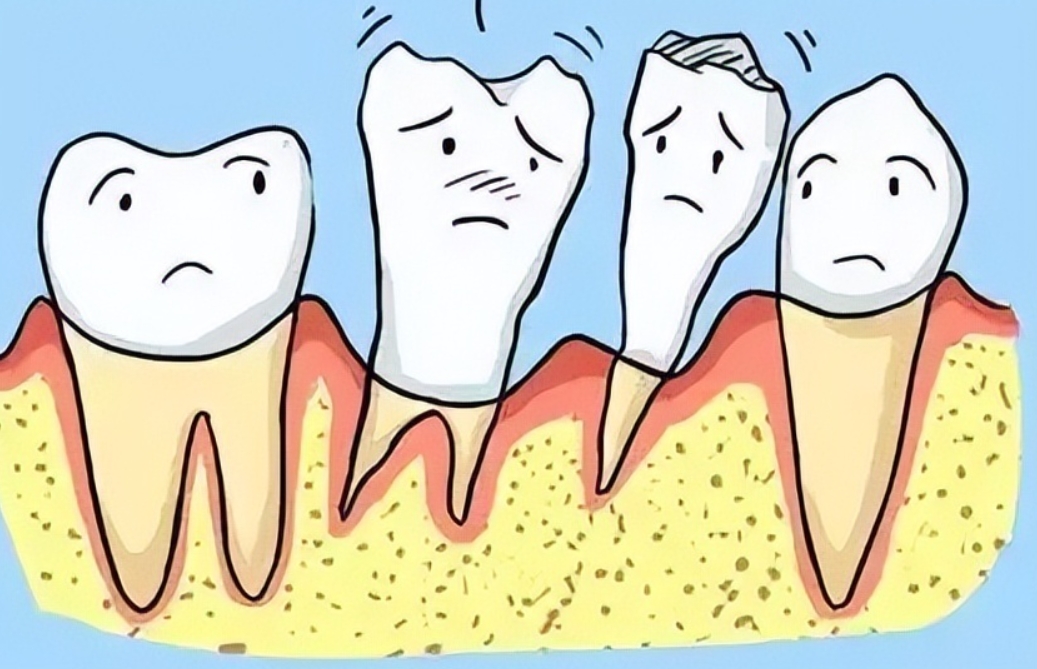 Seven major symptoms of periodontal disease