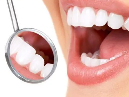 4 major misunderstandings about teeth whitening, don’t make any more mistakes after reading this!