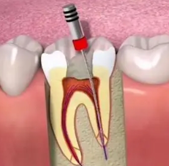 Three major reasons why my tooth hurts at night but does not hurt during the day. Which hospital should I go to?