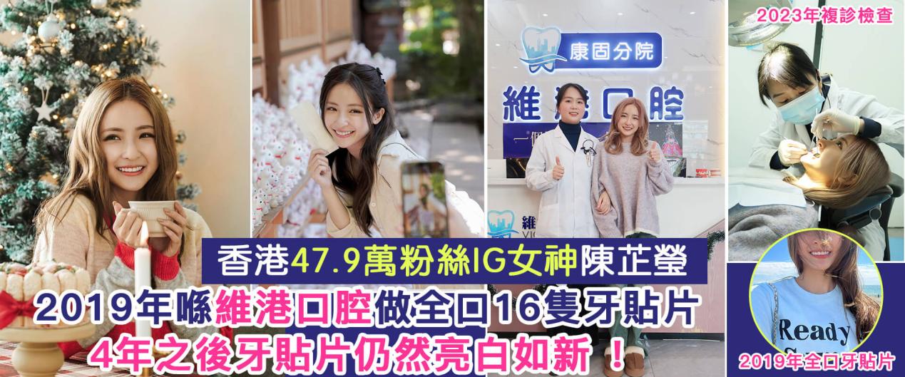 Macau Smart Tooth Price: Why do smart teeth appear