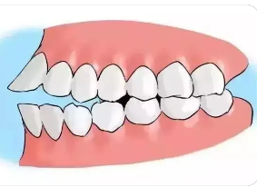 牙齿矫正3