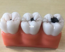 补牙3