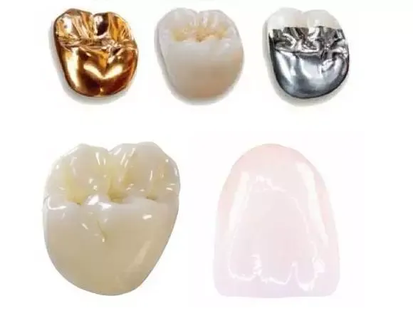 Zhuhai denture prices: types of dentures and their prices