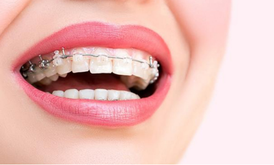 Which is the best dental orthodontic hospital in Macau? | Recommended dentists by Macau residents. Refuse hard sales for dental care.